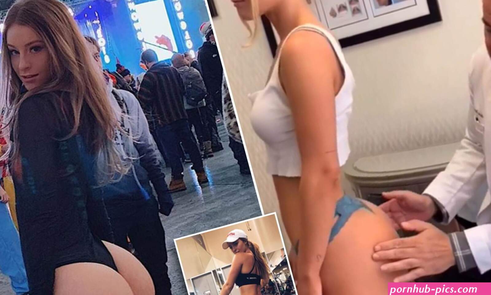 Teenage influencer has plastic surgeon CERTIFY that her butt is 100 real