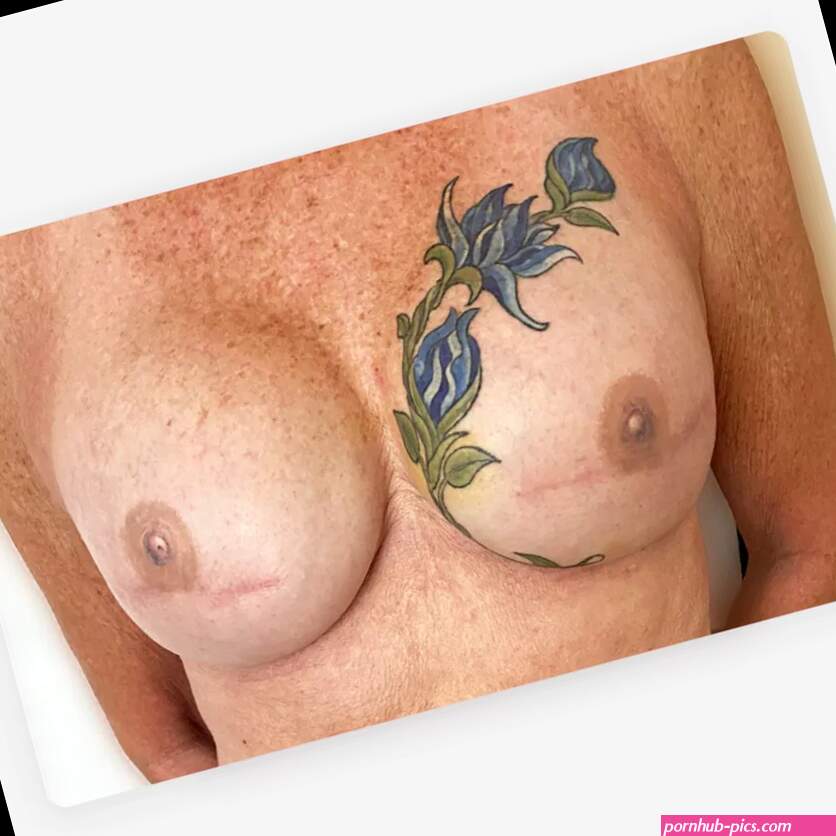What It Looks Like: Double Mastectomy with Implants and Nipple Tattoos