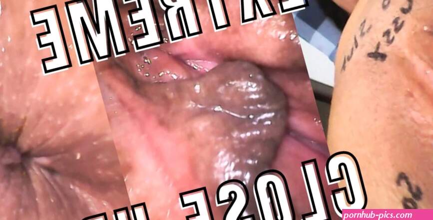 Nice Penis Endoscope Hole Porn Videos