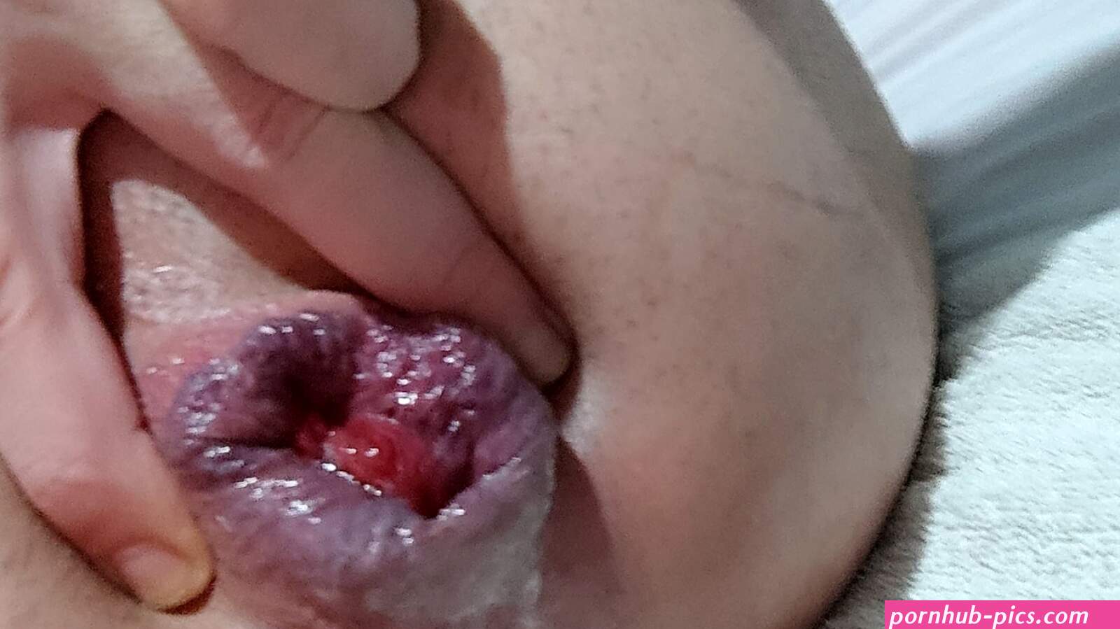 My destroyed pussy: 5 Nude Pics
