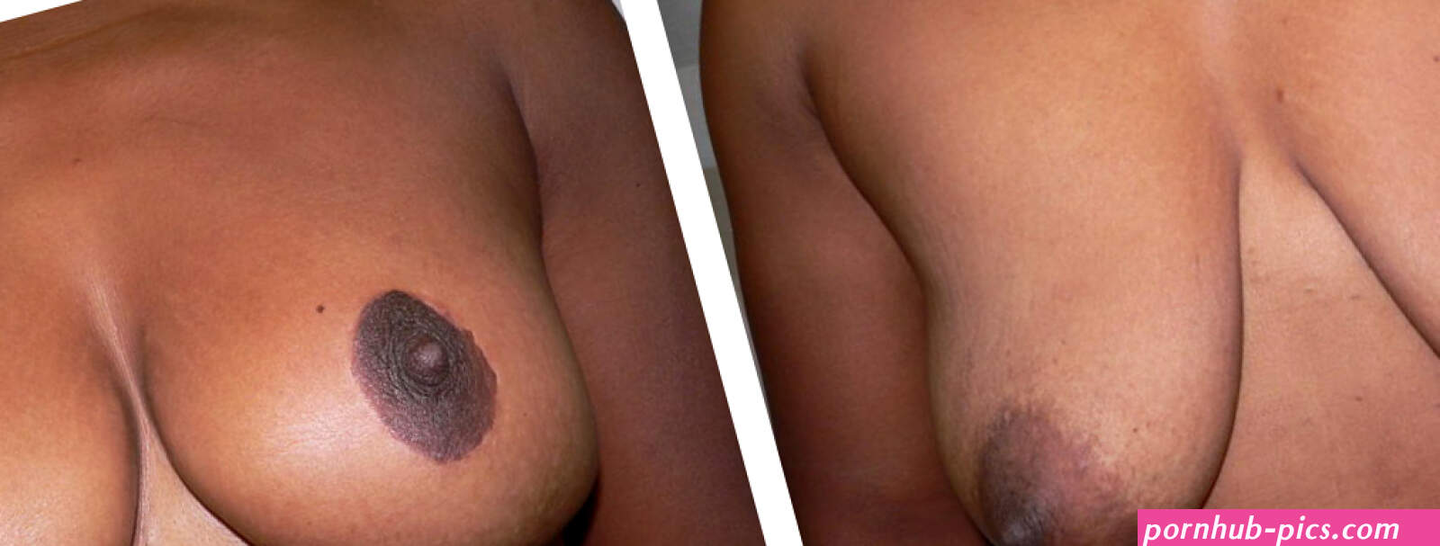 How One Surgeon Is Reinventing the Female Breast SFW