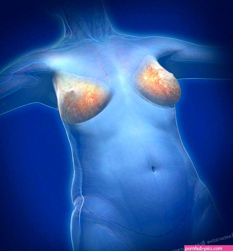 Botched Breast Reconstruction Corrective Options