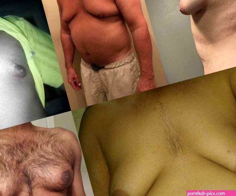 Gynecomastia Check: 4 Clear Signs Every Man Should Know