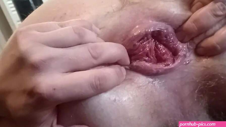 Anal boquiabierto