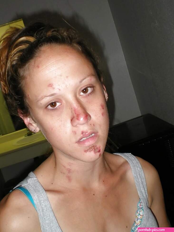 Beat Down Crack Whore Bree: 18 Nude Pics