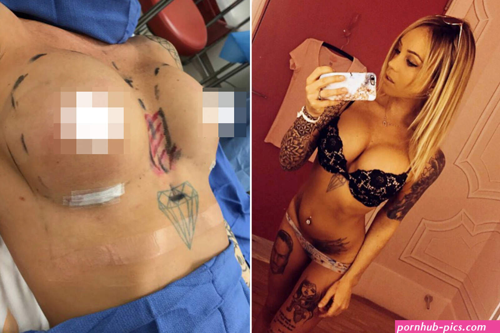 Botched boob job turns nude model into a monster