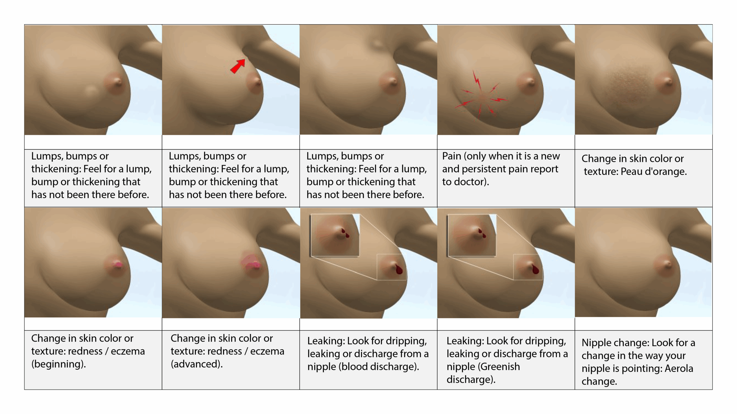 BREAST CANCER BREAST SELF-EXAMINATION BSE
