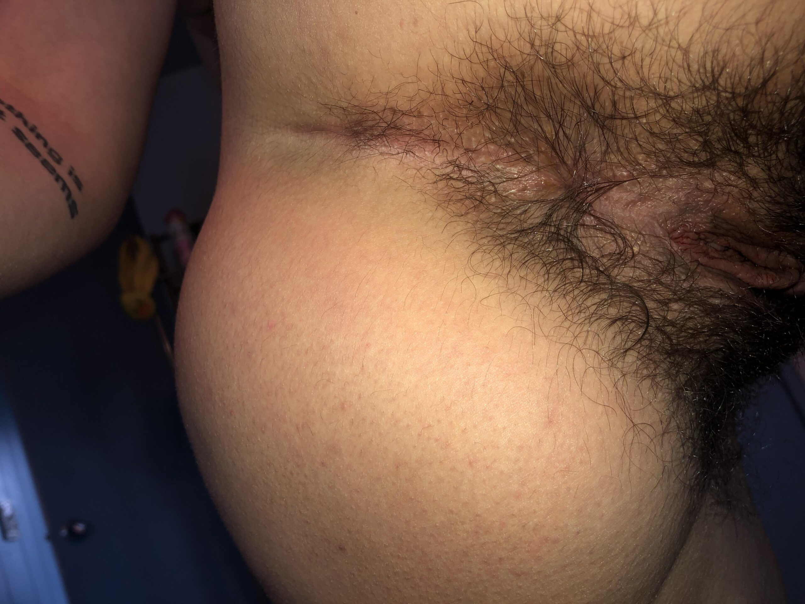 Heres my hairy ass for u. more on my onlyfans