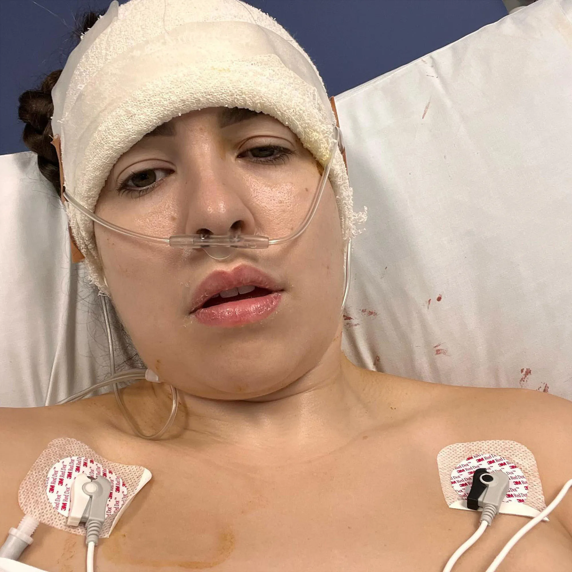 OnlyFans model has brain surgery kept taking nudes in hospital