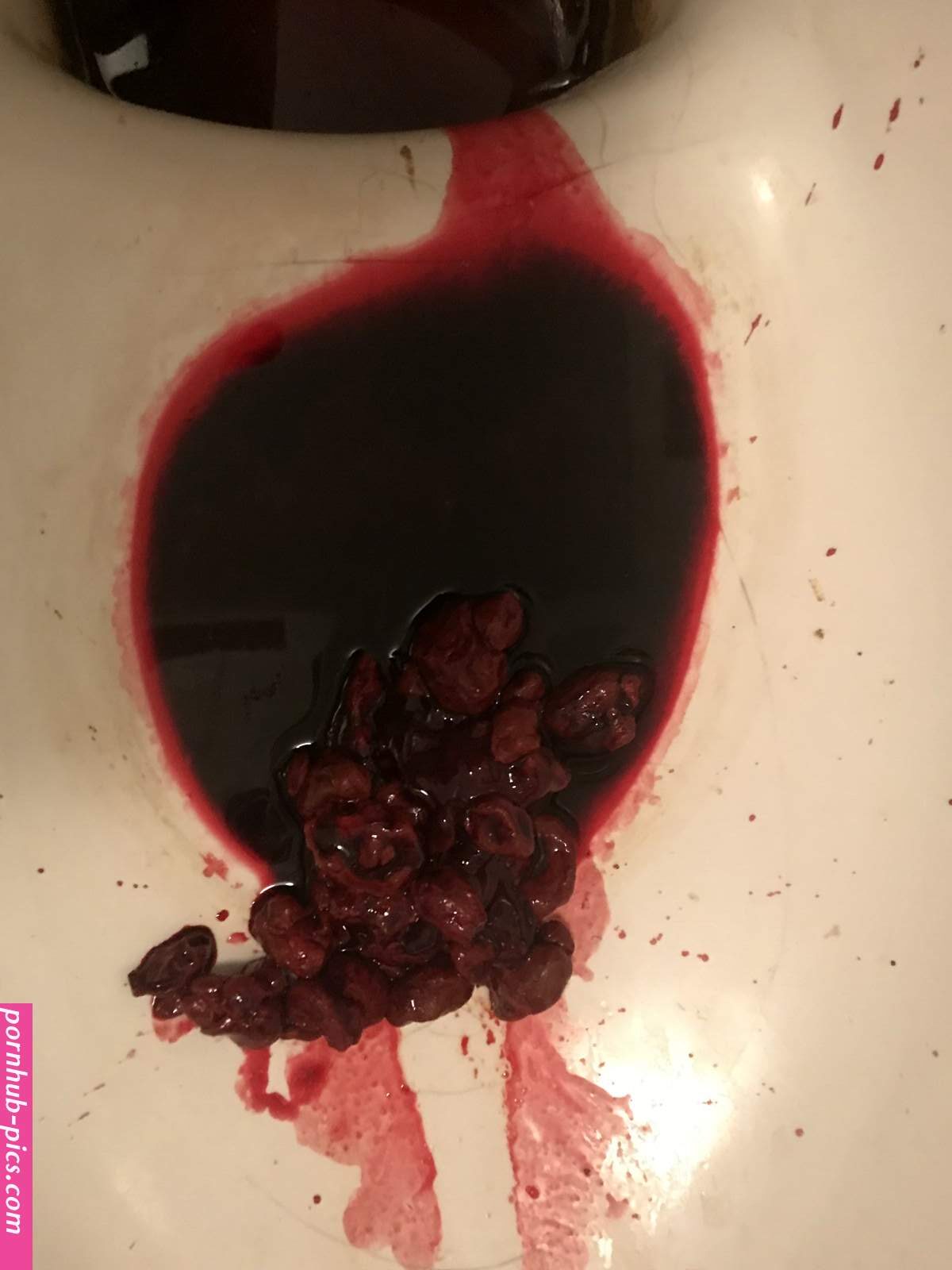 Hematochezia