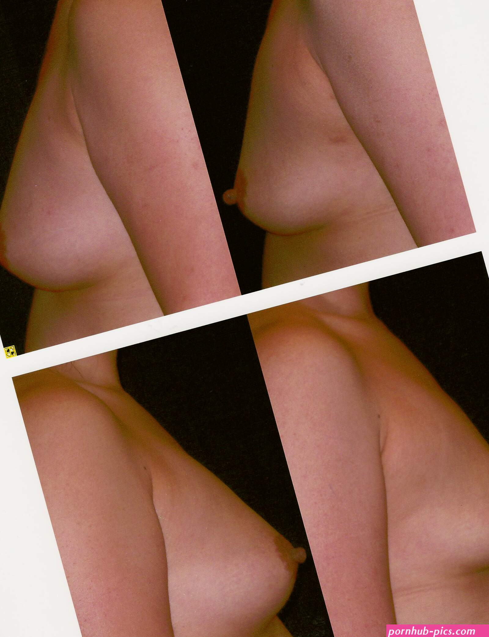 Im really liking fat transfer to the breast and so are my patients.